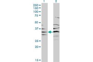 Western Blot analysis of BPNT1 expression in transfected 293T cell line by BPNT1 monoclonal antibody (M01), clone 2E1.