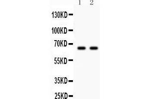 Western blot testing of Parkin antibody and Lane 1:  U87;  2: mouse brain lysate. (Parkin anticorps  (AA 23-416))