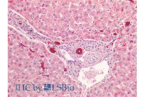 ABIN1781977 (5µg/ml) staining of paraffin embedded Human Liver. (Cytokeratin 19 anticorps  (C-Term))