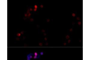 Immunofluorescence analysis of NIH/3T3 cells using TBP Polyclonal Antibody at dilution of 1:100 (40x lens). (TBP anticorps)