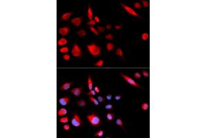 Immunofluorescence analysis of U2OS cells using KIF2C antibody (ABIN5973166). (KIF2C anticorps)