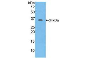 Western blot analysis of recombinant Human SYK. (SYK anticorps  (AA 374-635))
