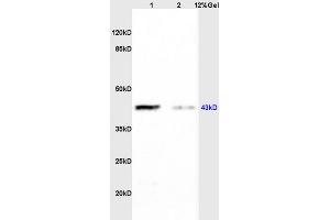 Lane 1: rat brain lysates Lane 2: rat heart lysates probed with Anti CK II alpha/STKPolyclonal Antibody, Unconjugated (ABIN731978) at 1:200 in 4 °C. (CSNK2A1/CK II alpha anticorps  (AA 201-300))