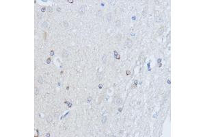 Immunohistochemistry of paraffin-embedded rat brain using RALGDS antibody (ABIN7269838) at dilution of 1:100 (40x lens).