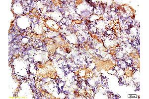 Formalin-fixed and paraffin embedded rat liver tissue with Anti-Collagen IV Polyclonal Antibody, Unconjugated (ABIN728413) at 1:200, followed by conjugation to the secondary antibody and DAB staining (Collagen IV anticorps  (AA 1401-1500))