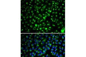 Immunofluorescence analysis of HeLa cells using CYP2E1 Polyclonal Antibody (CYP2E1 anticorps)
