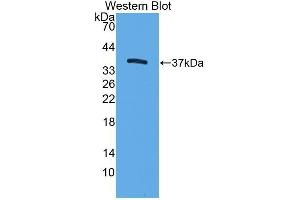 Western Blotting (WB) image for anti-Trefoil Factor 3 (Intestinal) (TFF3) antibody (Biotin) (ABIN1174902)