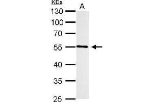 WB Image CYP1B1 antibody detects CYP1B1 protein by Western blot analysis.
