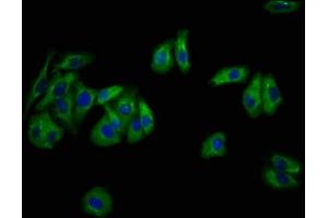 Immunofluorescence staining of HepG2 cells with ABIN7169579 at 1:133, counter-stained with DAPI. (Sialidase 4 anticorps  (AA 225-377))