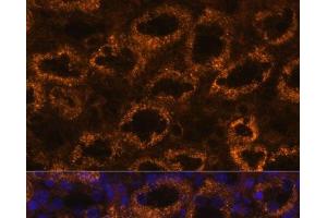 Immunofluorescence analysis of Rat kidney using SLC7A9 Polyclonal Antibody at dilution of 1:100.