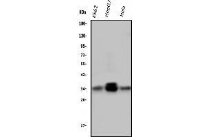 Western blot analysis of PPT1 using anti-PPT1 antibody (ABIN6719501).