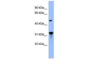 NIT1 antibody used at 1 ug/ml to detect target protein. (Nitrilase 1 anticorps  (N-Term))