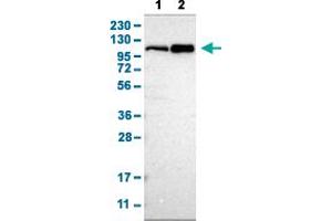 Western Blot analysis with CUL4B polyclonal antibody . (Cullin 4B anticorps  (AA 9-152))