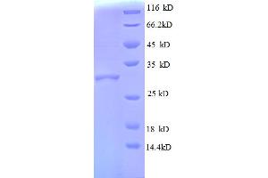 SDS-PAGE (SDS) image for Ribosomal Protein L30 (RPL30) (AA 1-59), (full length) protein (GST tag) (ABIN5712630)