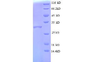 SDS-PAGE (SDS) image for Ribosomal Protein L30 (RPL30) (AA 1-59), (full length) protein (GST tag) (ABIN5712630) (RPL30 Protein (AA 1-59, full length) (GST tag))