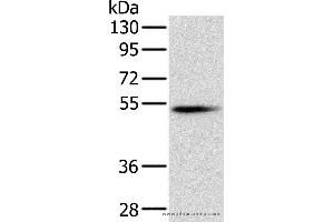 Western blot analysis of Mouse pancreas tissue, using PNLIP Polyclonal Antibody at dilution of 1:400 (PNLIP anticorps)