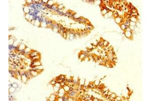 Immunohistochemistry of paraffin-embedded human small intestine tissue using ABIN7160672 at dilution of 1:100