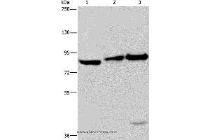 Western blot analysis of NIH/3T3 cell, mouse lung and liver tissue, using ECE1 Polyclonal Antibody at dilution of 1:550 (ECE1 anticorps)