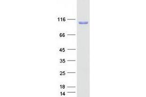 Validation with Western Blot