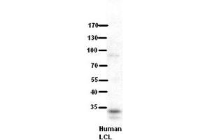 WB Suggested Anti-RRP1B Antibody Titration:  5% Milk  ELISA Titer:  dilution: 1:500  Positive Control:  human LCL (RRP1B anticorps  (Middle Region))