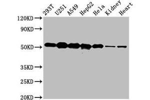 Western Blot Positive WB detected in: 293T whole cell lysate, U251 whole cell lysate, A549 whole cell lysate, HepG2 whole cell lysate, Hela whole cell lysate, Rat kidney tissue, Mouse heart tissue All lanes: SLC25A24 antibody at 5 μg/mL Secondary Goat polyclonal to rabbit IgG at 1/50000 dilution Predicted band size: 54, 52 kDa Observed band size: 54 kDa