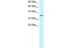 WB Suggested Anti-RPS16 Antibody Titration:  1. (RPS16 anticorps  (Middle Region))
