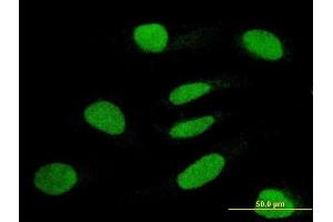 Immunofluorescence of monoclonal antibody to TRIM63 on HeLa cell.