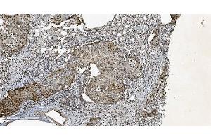 IHC analysis of HP1 alpha/CBX5 using anti-HP1 alpha/CBX5 antibody (ABIN7599057). (CBX5 anticorps  (AA 1-191))