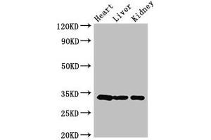 Western Blot Positive WB detected in: Mouse heart tissue, Mouse liver tissue, Mouse kidney tissue All lanes: CCND2 antibody at 3. (Cyclin D2 anticorps  (AA 215-285))