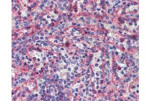 Immunohistochemistry with HeLa, Vera, HeLa transfected with mouse construct tissue