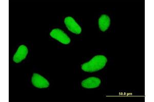 Immunofluorescence of monoclonal antibody to UBE2E2 on HeLa cell. (UBE2E2 anticorps  (AA 1-201))