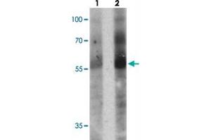 Western blot analysis of TOX in human colon tissue with TOX polyclonal antibody  at (1) 1 and (2) 2 ug/mL. (TOX anticorps  (N-Term))