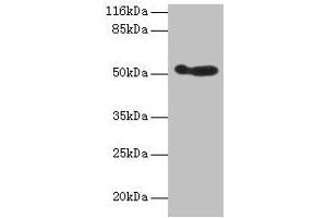 Western blot All lanes: ALDH3A1 antibody at 2 μg/mL + 293T whole cell lysate Secondary Goat polyclonal to rabbit IgG at 1/10000 dilution Predicted band size: 51 kDa Observed band size: 51 kDa