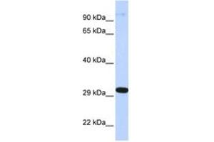 Image no. 1 for anti-Zinc Finger Protein 688 (ZNF688) (AA 72-121) antibody (ABIN6742728) (ZNF688 anticorps  (AA 72-121))
