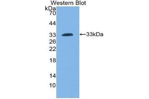 Western Blotting (WB) image for anti-Lymphocyte Cytosolic Protein 2 (SH2 Domain Containing Leukocyte Protein of 76kDa) (LCP2) (AA 202-463) antibody (ABIN1859636) (LCP2 anticorps  (AA 202-463))