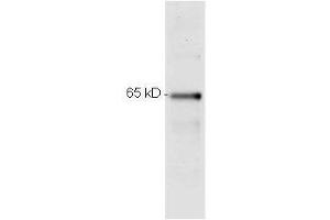 monoclonal anti p65  was used to detect p65 by Western blot.