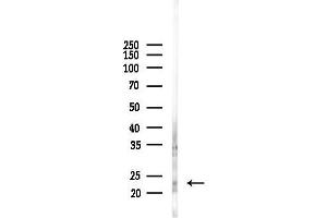 Western blot analysis of lysates from Mouse brain, using Phospho-TNNI3 (Ser44) Antibody at 1/1000 dilution.