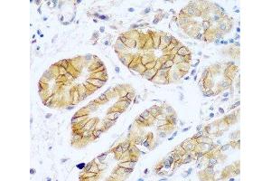 Immunohistochemistry of paraffin-embedded Human stomach using NCAM1 / CD56 Polyclonal Antibody at dilution of 1:100 (40x lens). (CD56 anticorps)