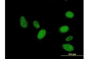 Immunofluorescence of purified MaxPab antibody to RNF36 on HeLa cell. (TRIM69 anticorps  (AA 1-341))