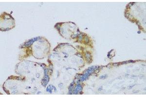 Immunohistochemistry of paraffin-embedded Human placenta using CYP11A1 Polyclonal Antibody at dilution of 1:150 (40x lens). (CYP11A1 anticorps)