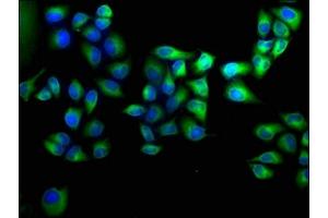 Immunofluorescence staining of Hela cells with ABIN7144218 at 1:100, counter-stained with DAPI. (ANKRD2 anticorps  (AA 1-210))