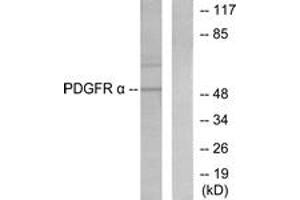 Western blot analysis of extracts from HepG2 cells, using Peripherin Antibody. (Peripherin anticorps  (AA 421-470))