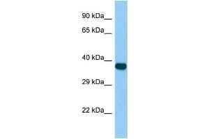 Host:  Rabbit  Target Name:  Zfp367  Sample Type:  Rat Spleen lysates  Antibody Dilution:  1. (ZNF367 anticorps  (C-Term))