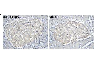 Changes in adrenal glands and pancreas in acNTS injured mice. (Insulin anticorps  (AA 46-59))