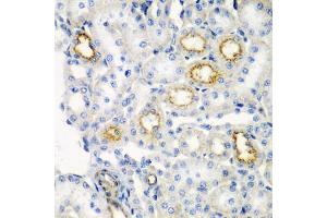 Immunohistochemistry of paraffin-embedded rat kidney using RARRES2 antibody (ABIN5974187) at dilution of 1/200 (40x lens). (Chemerin anticorps)