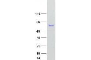Validation with Western Blot