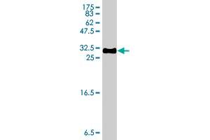 Western Blot detection against Immunogen (31.