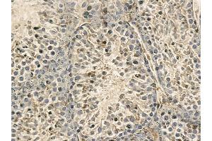 DNAAF1 Mouse Monoclonal Antibody at 1/100 staining mouse testis tissue by IHC-P. (LRRC50 anticorps)