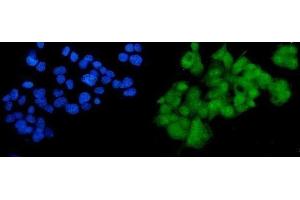 IF analysis of SOX18 using anti-SOX18 antibody (ABIN7602205). (SOX18 anticorps  (AA 63-362))