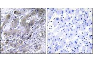 Immunohistochemistry (IHC) image for anti-Mitochondrial Ribosomal Protein S18A (MRPS18A) (AA 81-130) antibody (ABIN2890041) (MRPS18A anticorps  (AA 81-130))